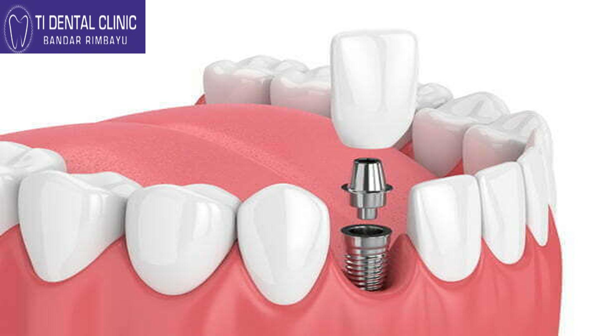 www.tidental.com.my
