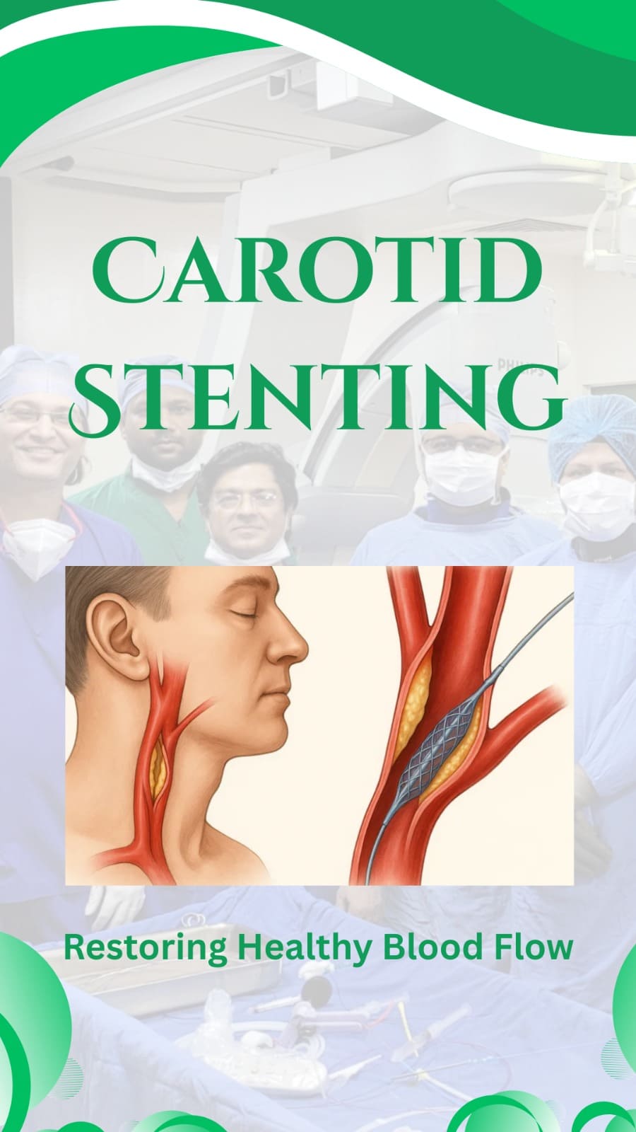 Carotid Artery Stenting India | Advanced Stroke Prevention | IRFacilities